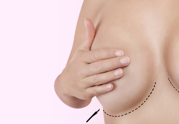 Подтяжка и уменьшение груди
