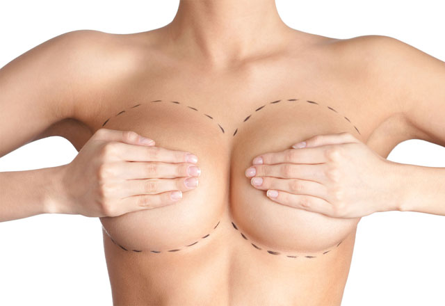 Krūtų asimetrijos korekcijos